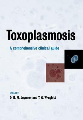 Toxoplasmosis: A Comprehensive Clinical Guide - cover