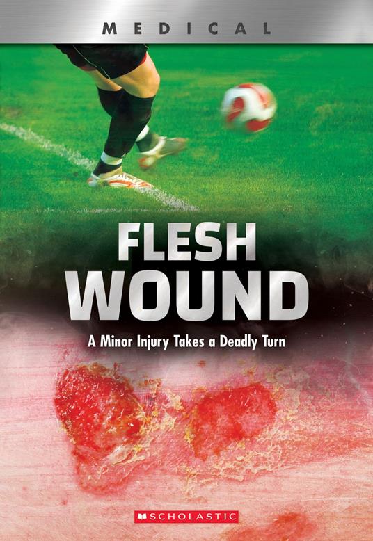 Flesh Wound: A Minor Injury Takes a Deadly Turn (XBooks) - Shea Phillips - ebook