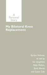 My Bilateral Knee Replacement: A Personal Story