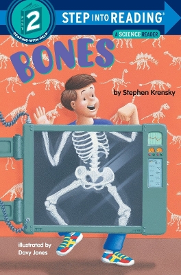 ibs