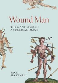 Wound Man: The Many Lives of a Surgical Image