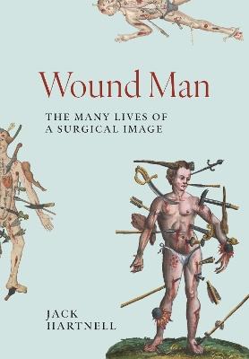 Wound Man: The Many Lives of a Surgical Image - Jack Hartnell - cover