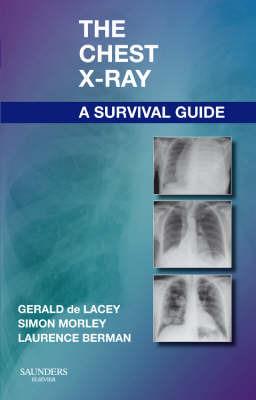 The Chest X-Ray: A Survival Guide - Gerald de Lacey,Simon Morley,Laurence Berman - cover