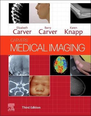 Carvers' Medical Imaging - Elizabeth Carver,Barry Carver,Karen Knapp - cover