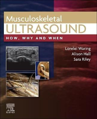 Musculoskeletal Ultrasound: How, Why and When - Lorelei Waring,Alison Hall,Sara Riley - cover