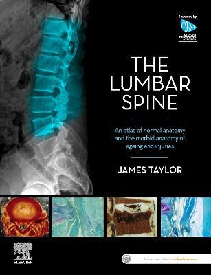 The Lumbar Spine: An Atlas of Normal Anatomy and the Morbid Anatomy of Ageing and Injury - James Taylor - cover