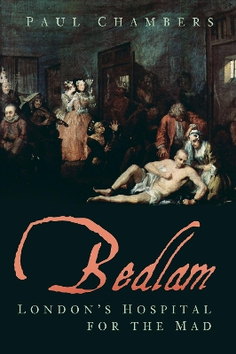 ibs