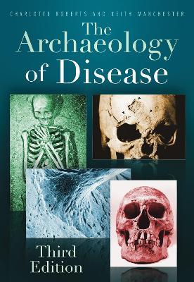 The Archaeology of Disease: Third Edition - Charlotte Roberts,Keith Manchester - cover