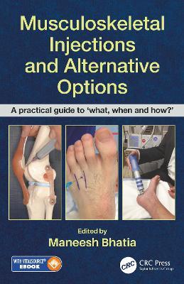 Musculoskeletal Injections and Alternative Options: A practical guide to 'what, when and how?' - cover