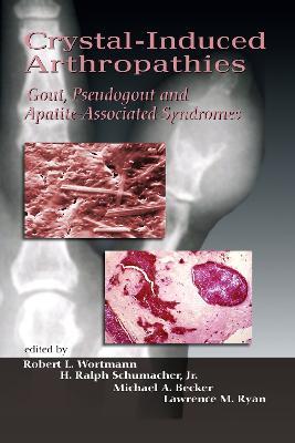 Crystal-Induced Arthropathies: Gout, Pseudogout and Apatite-Associated Syndromes - cover