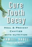 Cure Tooth Decay: Heal and Prevent Cavities with Nutrition (First Edition)