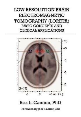 Low Resolution Brain Electromagnetic Tomography (LORETA): Basic Concepts and Clinical Applications - Rex Cannon - cover