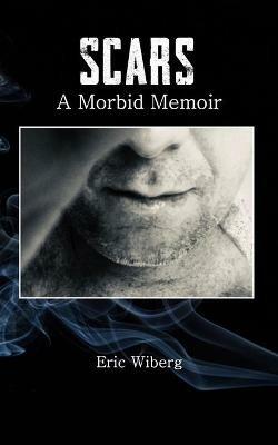 Scars: A Morbid Memoir - Eric Wiberg - cover