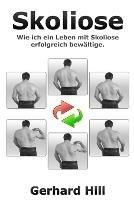 Skoliose: Wie ich ein Leben mit Skoliose erfolgreich bewaltige