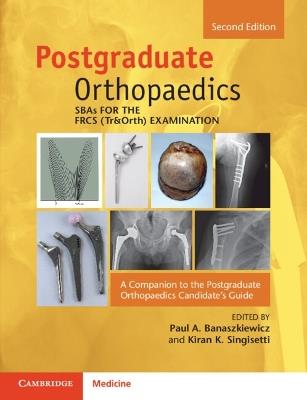 SBAs for the FRCS (Tr&Orth) Examination: A Companion to the Postgraduate Orthopaedics Candidate's Guide - cover