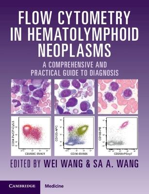 Flow Cytometry in Hematolymphoid Neoplasms: A Comprehensive and Practical Guide to Diagnosis - cover
