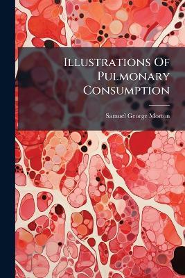 Illustrations Of Pulmonary Consumption - Samuel George Morton - cover