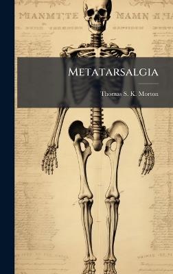 Metatarsalgia - cover