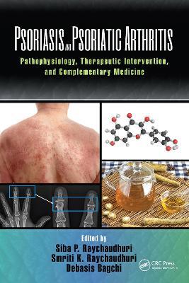Psoriasis and Psoriatic Arthritis: Pathophysiology, Therapeutic Intervention, and Complementary Medicine - cover