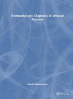 Histopathologic Diagnosis of Invasive Mycoses