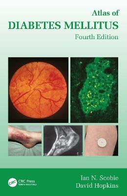 Atlas of Diabetes Mellitus - Ian N. Scobie,David Hopkins - cover