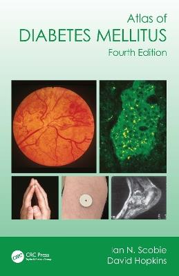Atlas of Diabetes Mellitus - Ian N. Scobie,David Hopkins - cover