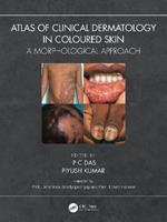 Atlas of Clinical Dermatology in Coloured Skin: A Morphological Approach