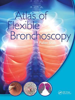 Atlas of Flexible Bronchoscopy - Pallav Shah - cover