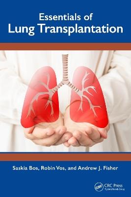 Essentials of Lung Transplantation - Saskia Bos,Robin Vos,Andrew J. Fisher - cover