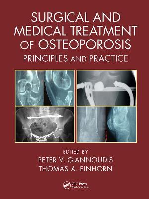 Surgical and Medical Treatment of Osteoporosis: Principles and Practice - cover