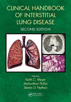 Clinical Handbook of Interstitial Lung Disease - cover