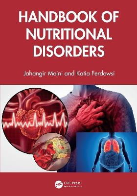 Handbook of Nutritional Disorders - Jahangir Moini,Katia Ferdowsi - cover