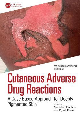 Cutaneous Adverse Drug Reactions: A Case Based Approach for Deeply Pigmented Skin - cover