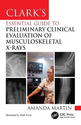 Clark’s Essential Guide to Preliminary Clinical Evaluation of Musculoskeletal X-rays - Amanda Martin - cover
