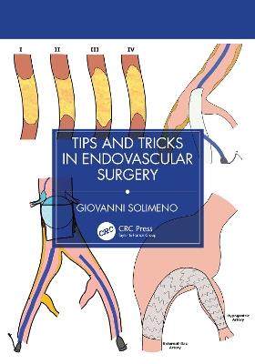 Tips and Tricks in Endovascular Surgery: A "How to" Guide for reaching the next Level in Endovascular Surgery - Giovanni Solimeno - cover
