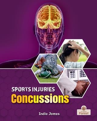 Concussions - India James - cover