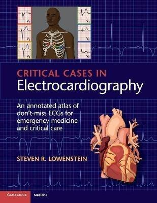 Critical Cases in Electrocardiography: An Annotated Atlas of Don't-Miss ECGs for Emergency Medicine and Critical Care - Steven R. Lowenstein - cover