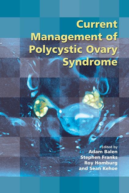 Current Management of Polycystic Ovary Syndrome