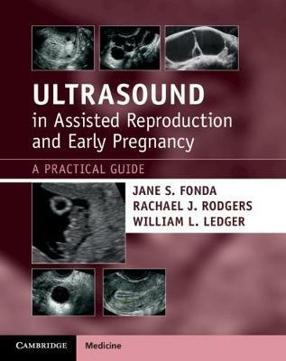 Ultrasound in Assisted Reproduction and Early Pregnancy: A Practical Guide - Jane S. Fonda,Rachael J. Rodgers,William L. Ledger - cover