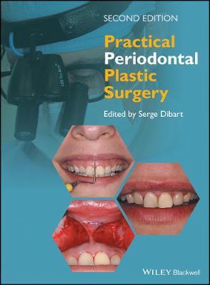 Practical Periodontal Plastic Surgery - cover