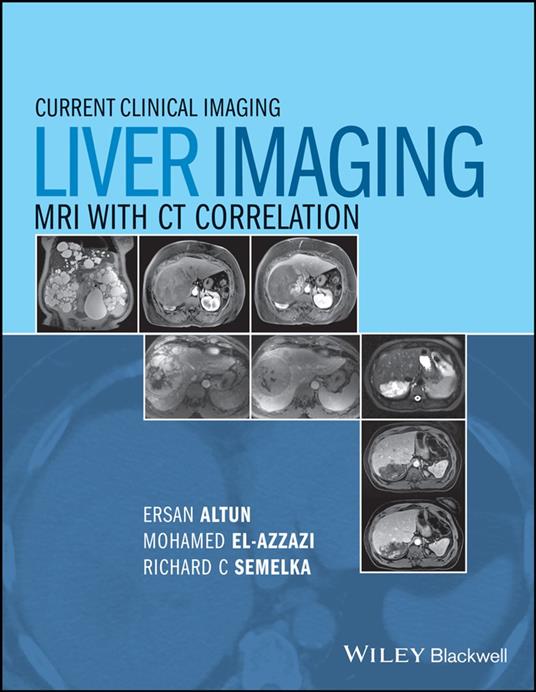Liver Imaging