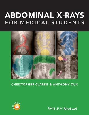 Abdominal X-rays for Medical Students - Christopher Clarke,Anthony Dux - cover