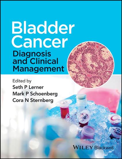 Bladder Cancer