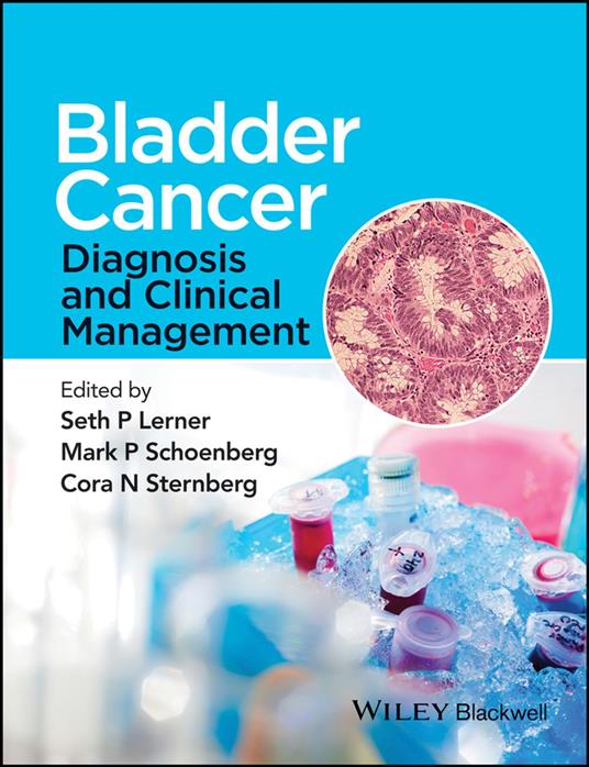 Bladder Cancer