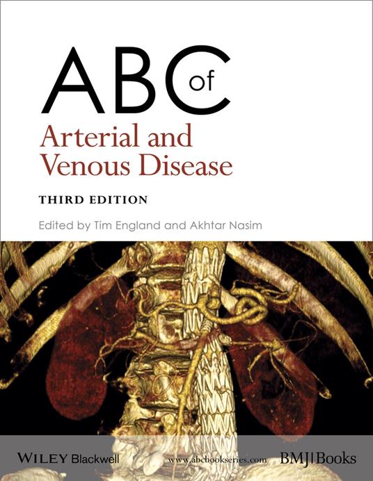 ABC of Arterial and Venous Disease - cover