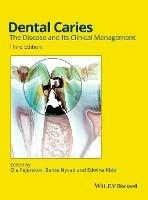 Dental Caries: The Disease and its Clinical Management - cover