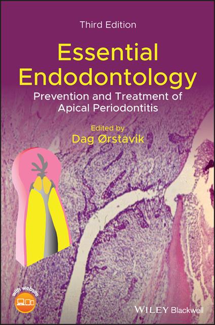 Essential Endodontology: Prevention and Treatment of Apical Periodontitis - cover