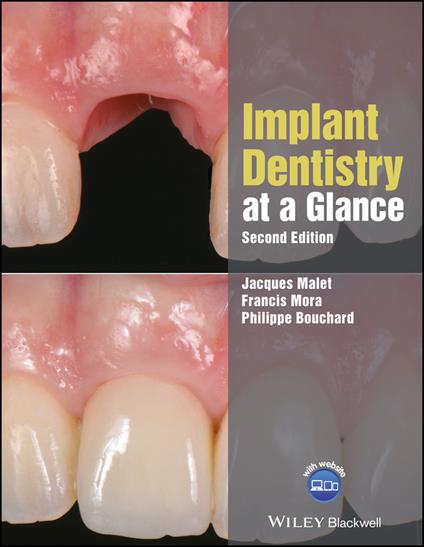Implant Dentistry at a Glance - Jacques Malet,Francis Mora,Philippe Bouchard - cover