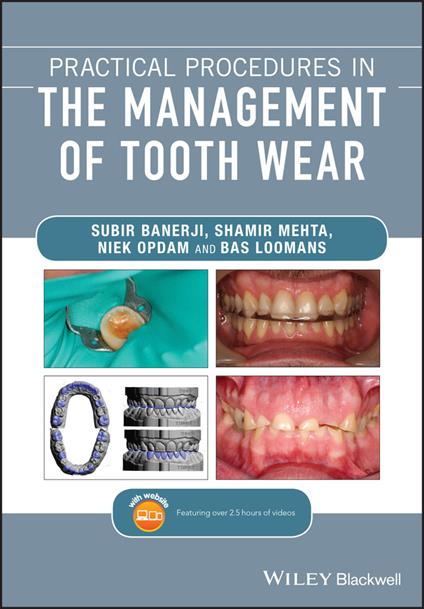 Practical Procedures in the Management of Tooth Wear - Subir Banerji,Shamir B. Mehta,Niek Opdam - cover