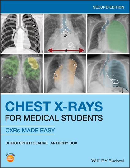 Chest X-Rays for Medical Students: CXRs Made Easy - Christopher Clarke,Anthony Dux - cover